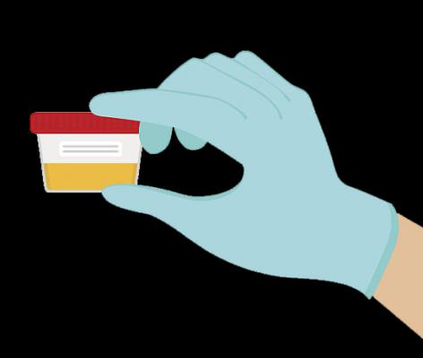 Urine Test